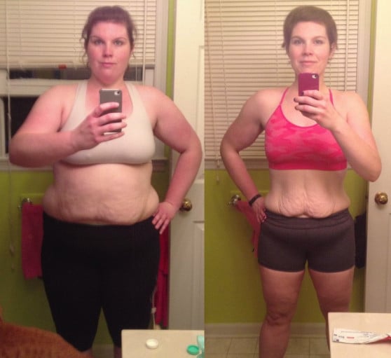 A photo of a 5'9" woman showing a weight cut from 317 pounds to 176 pounds. A total loss of 141 pounds.