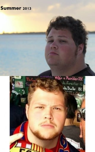 A before and after photo of a 5'10" male showing a weight reduction from 375 pounds to 240 pounds. A net loss of 135 pounds.