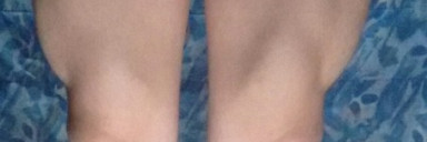 Progress Pics of 30 lbs Muscle Gain 5'5 Male 100 lbs to 130 lbs