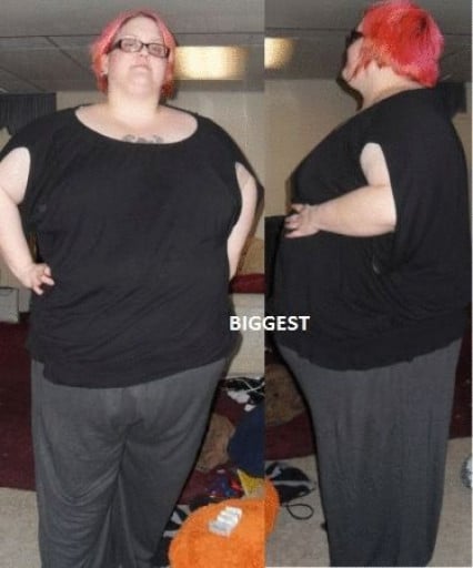A picture of a 5'7" female showing a fat loss from 396 pounds to 259 pounds. A net loss of 137 pounds.