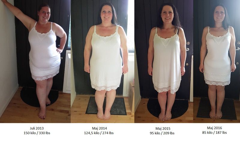 143 lbs Weight Loss 5 foot 8 Female 330 lbs to 187 lbs
