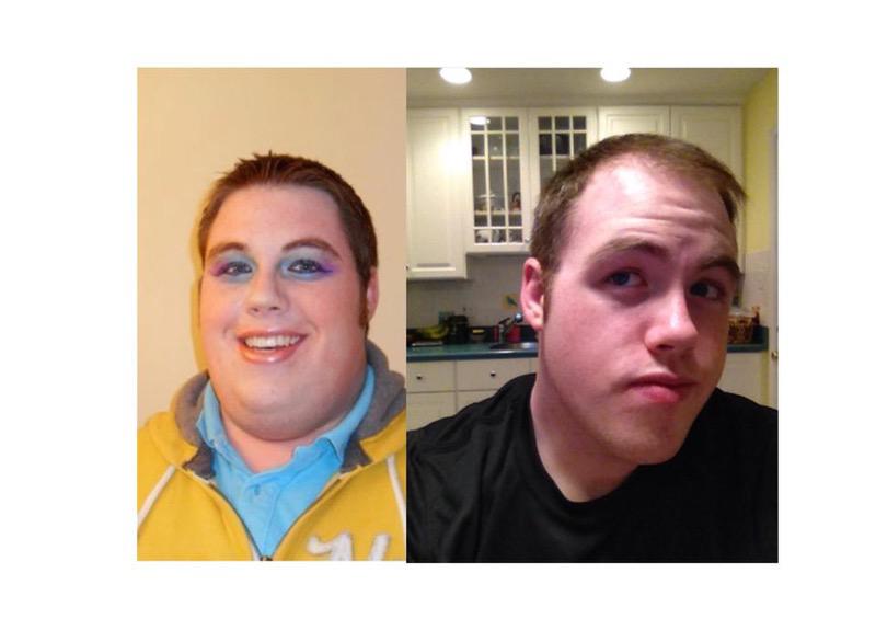 6 feet 5 Male Before and After 130 lbs Weight Loss 416 lbs to 286 lbs