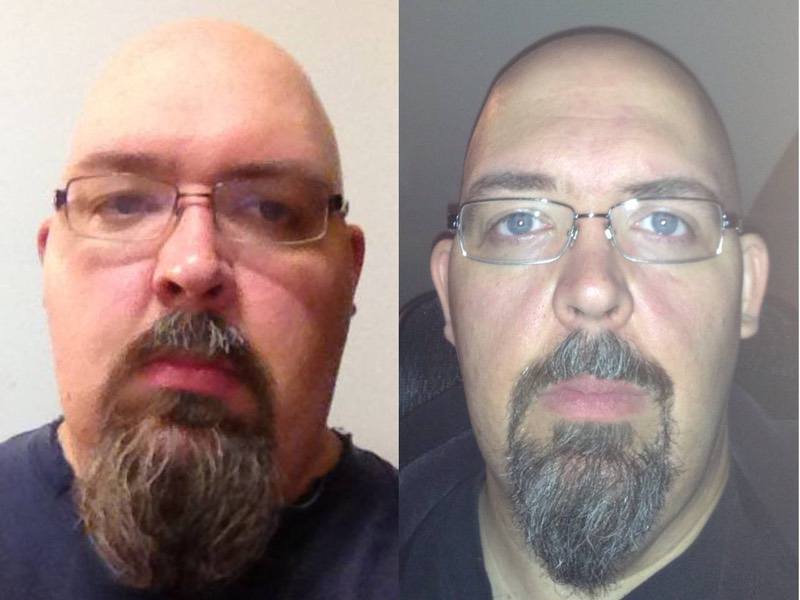 6 foot Male 128 lbs Weight Loss Before and After 432 lbs to 304 lbs