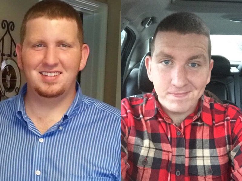 Before and After 65 lbs Fat Loss 5 feet 11 Male 310 lbs to 245 lbs
