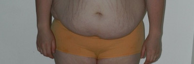 4 Pictures of a 5 feet 7 239 lbs Female Weight Snapshot