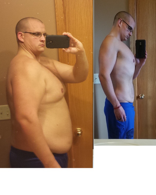 6'1 Male 100 lbs Fat Loss Before and After 318 lbs to 218 lbs
