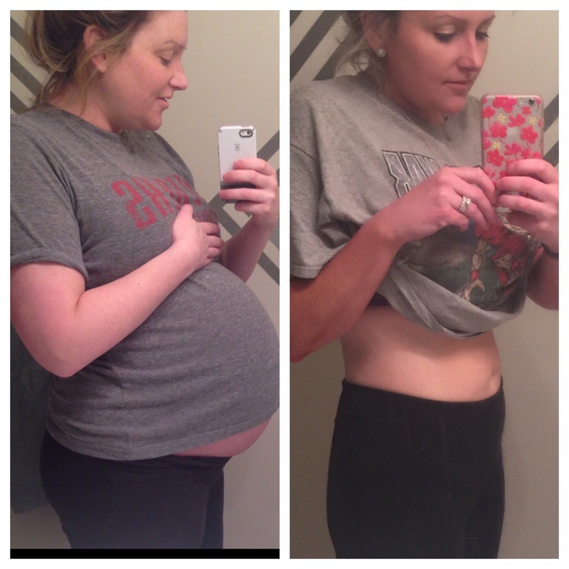 Progress Pics of 112 lbs Fat Loss 6 foot Female 290 lbs to 178 lbs
