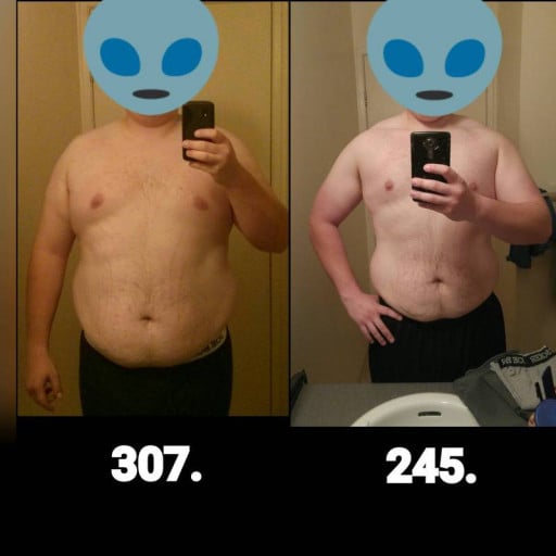 A before and after photo of a 6'0" male showing a weight reduction from 307 pounds to 245 pounds. A net loss of 62 pounds.