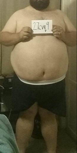 A progress pic of a person at 493 lbs