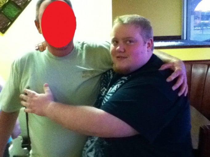 A before and after photo of a 5'9" male showing a weight cut from 395 pounds to 223 pounds. A net loss of 172 pounds.