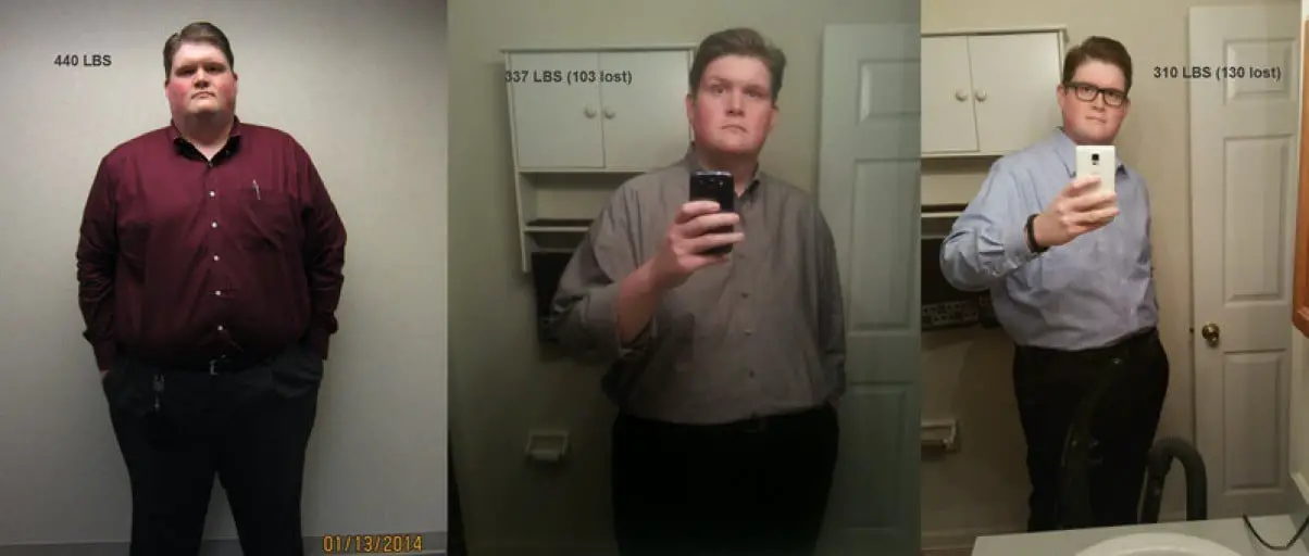 A picture of a 6'4" male showing a weight loss from 440 pounds to 310 pounds. A respectable loss of 130 pounds.