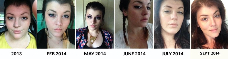 Before and After 72 lbs Fat Loss 5 foot 11 Female 250 lbs to 178 lbs