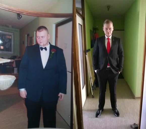 A picture of a 6'0" male showing a fat loss from 308 pounds to 175 pounds. A respectable loss of 133 pounds.