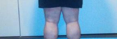 3 Pictures of a 290 lbs 5 feet 10 Male Weight Snapshot