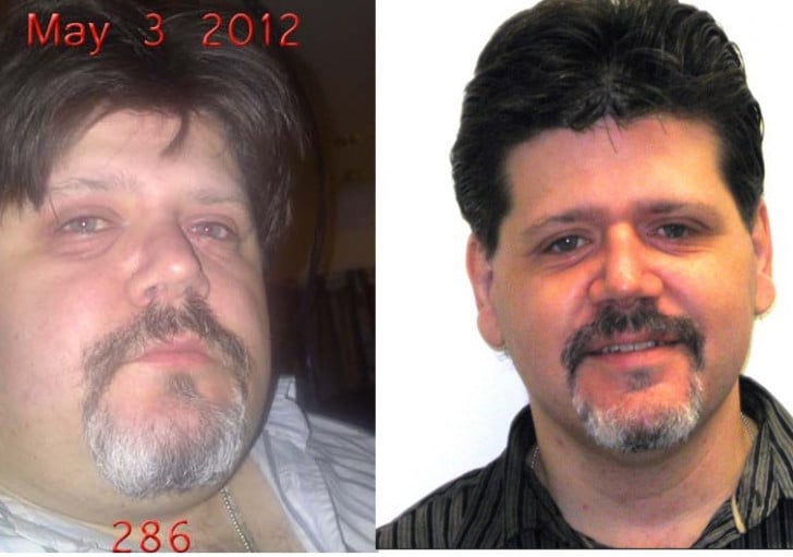 A before and after photo of a 5'6" male showing a weight reduction from 286 pounds to 183 pounds. A total loss of 103 pounds.