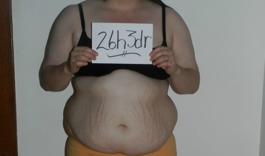 A before and after photo of a 5'7" female showing a snapshot of 239 pounds at a height of 5'7