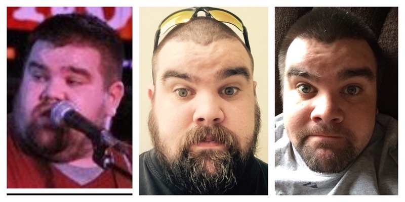 5 foot 9 Male Progress Pics of 85 lbs Weight Loss 380 lbs to 295 lbs