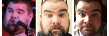 5 foot 9 Male Progress Pics of 85 lbs Weight Loss 380 lbs to 295 lbs