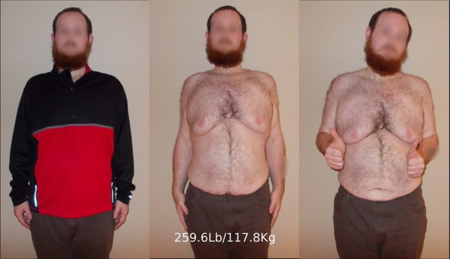 A progress pic of a 6'1" man showing a weight loss from 330 pounds to 232 pounds. A net loss of 98 pounds.