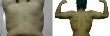 5'8 Male 193 lbs Fat Loss 380 lbs to 187 lbs
