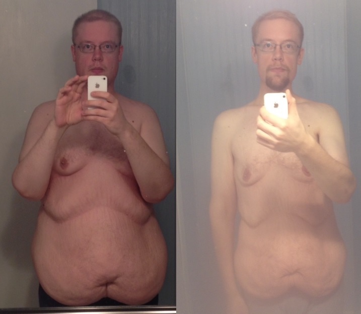 6'3 Male Progress Pics of 90 lbs Fat Loss 299 lbs to 209 lbs