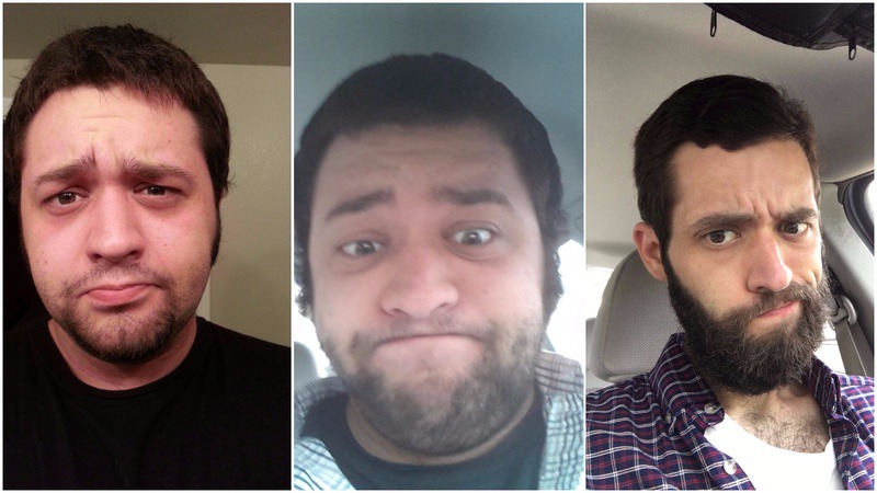 6'1 Male Progress Pics of 159 lbs Weight Loss 335 lbs to 176 lbs