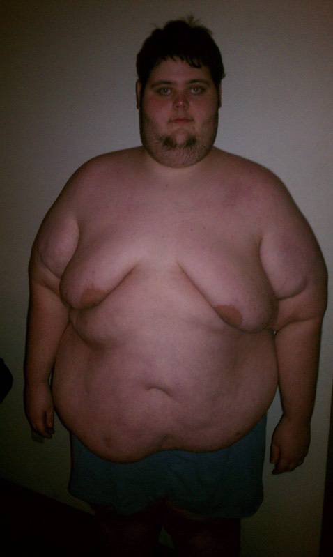 202 lbs Weight Loss Before and After 5 foot 8 Male 476 lbs to 274 lbs