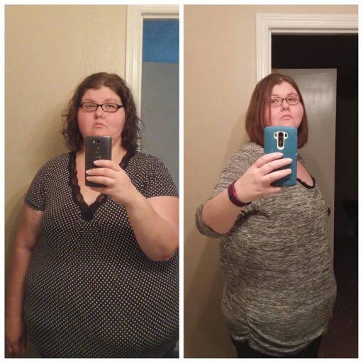 A before and after photo of a 5'10" female showing a weight reduction from 441 pounds to 299 pounds. A respectable loss of 142 pounds.