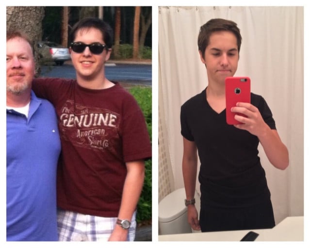 Teenager's Weight Loss Transformation Journey: a Story of Persistence and Triumph