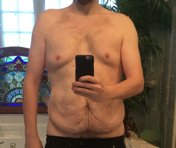 A before and after photo of a 6'1" male showing a fat loss from 374 pounds to 182 pounds. A respectable loss of 192 pounds.
