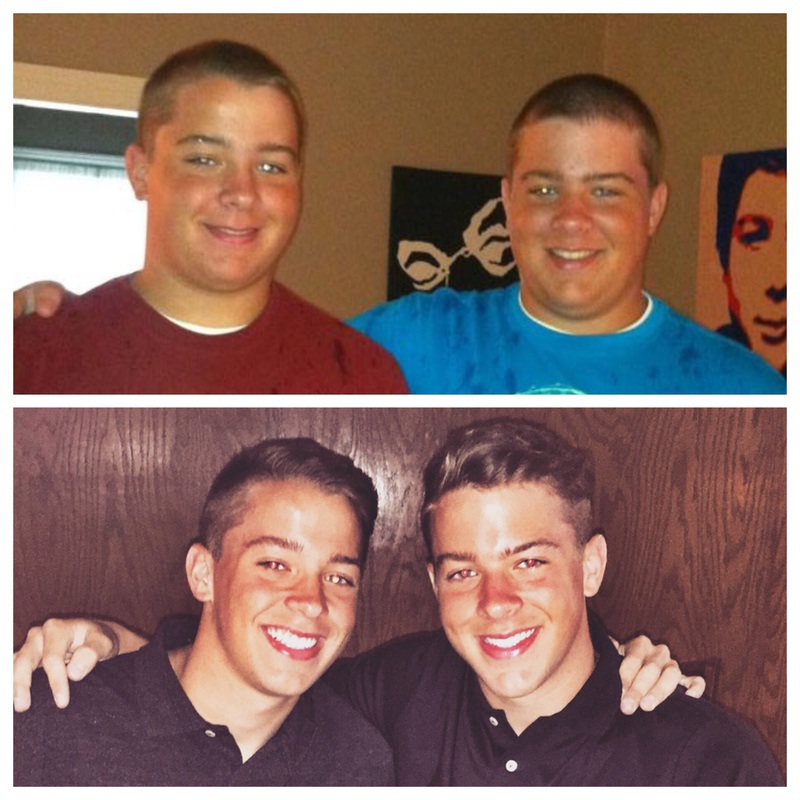 Progress Pics of 65 lbs Fat Loss 6'1 Male 240 lbs to 175 lbs