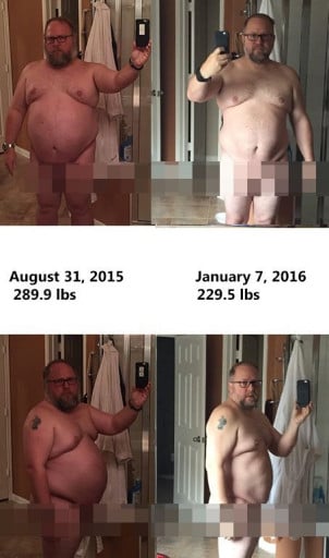5 feet 7 Male 60 lbs Fat Loss Before and After 289 lbs to 229 lbs