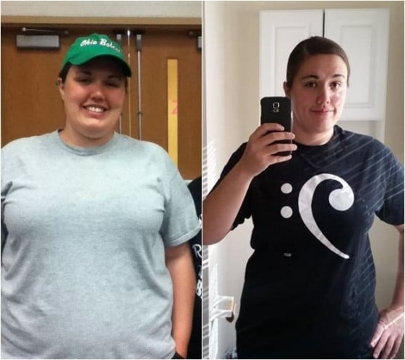 A before and after photo of a 5'7" female showing a weight reduction from 320 pounds to 210 pounds. A net loss of 110 pounds.