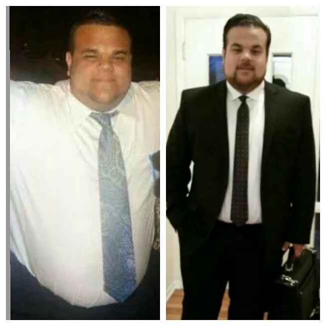 5'9 Male 70 lbs Weight Loss 375 lbs to 305 lbs