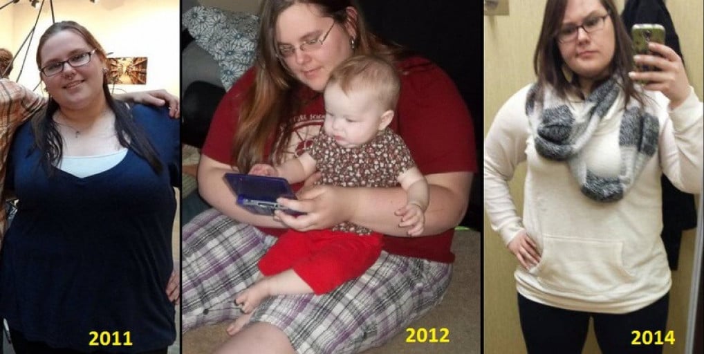 A picture of a 5'7" female showing a weight loss from 335 pounds to 249 pounds. A respectable loss of 86 pounds.