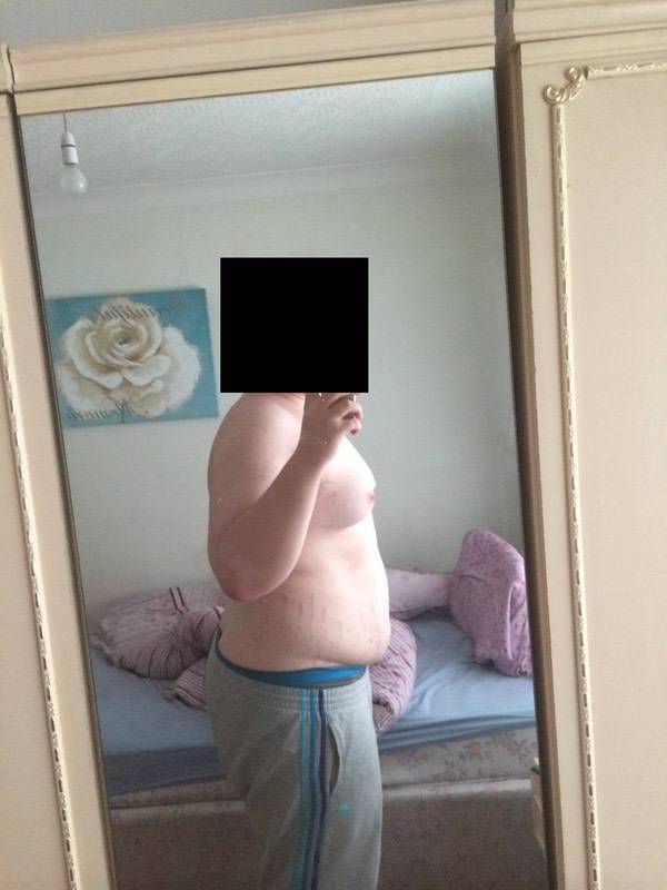 156 lbs Fat Loss Before and After 6 foot 3 Male 336 lbs to 180 lbs