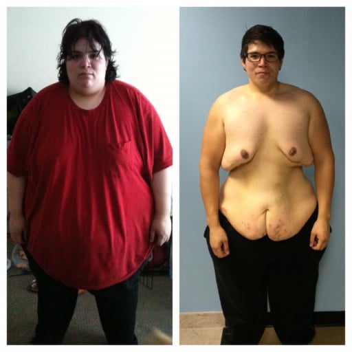 A photo of a 5'9" man showing a weight cut from 550 pounds to 285 pounds. A respectable loss of 265 pounds.