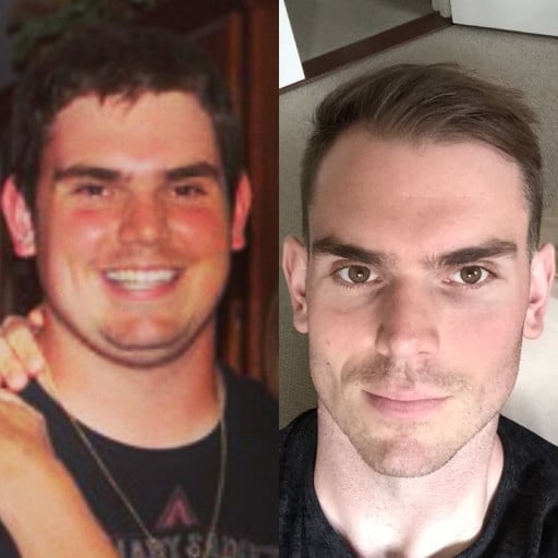 6 foot 5 Male Progress Pics of 89 lbs Fat Loss 309 lbs to 220 lbs
