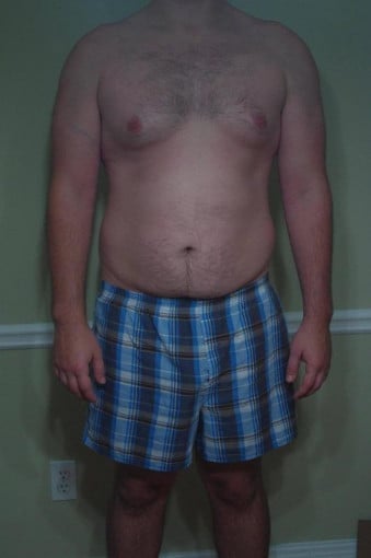 A before and after photo of a 6'2" male showing a snapshot of 241 pounds at a height of 6'2