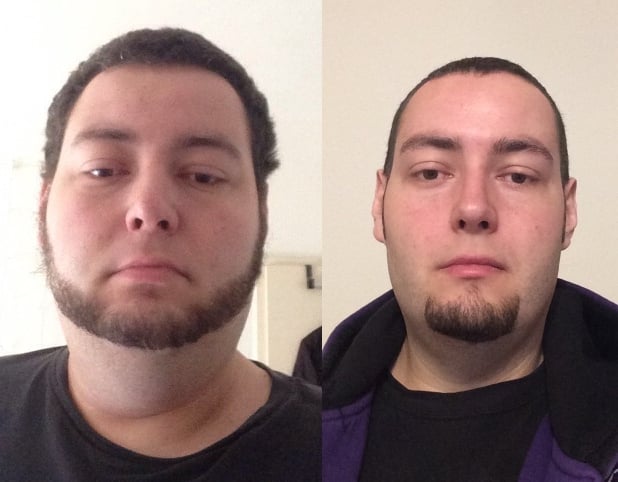 6 feet 2 Male 126 lbs Weight Loss Before and After 456 lbs to 330 lbs