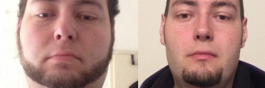 6 feet 2 Male 126 lbs Weight Loss Before and After 456 lbs to 330 lbs