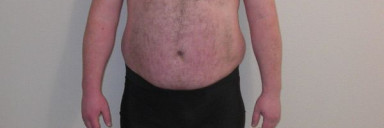 4 Photos of a 276 lbs 5 feet 10 Male Weight Snapshot