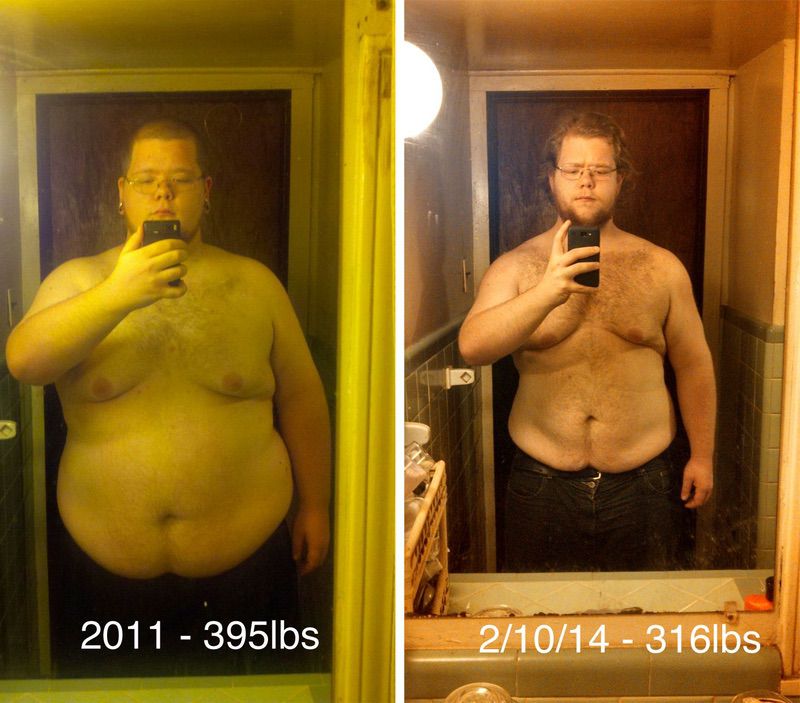 Before and After 79 lbs Weight Loss 6 feet 1 Male 395 lbs to 316 lbs