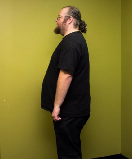 A progress pic of a 6'2" man showing a weight loss from 345 pounds to 260 pounds. A respectable loss of 85 pounds.