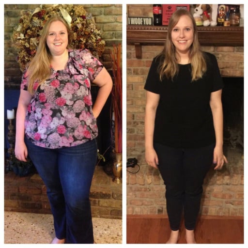 A before and after photo of a 5'10" female showing a weight reduction from 317 pounds to 202 pounds. A net loss of 115 pounds.