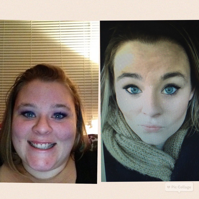 5'5 Female Before and After 120 lbs Weight Loss 320 lbs to 200 lbs