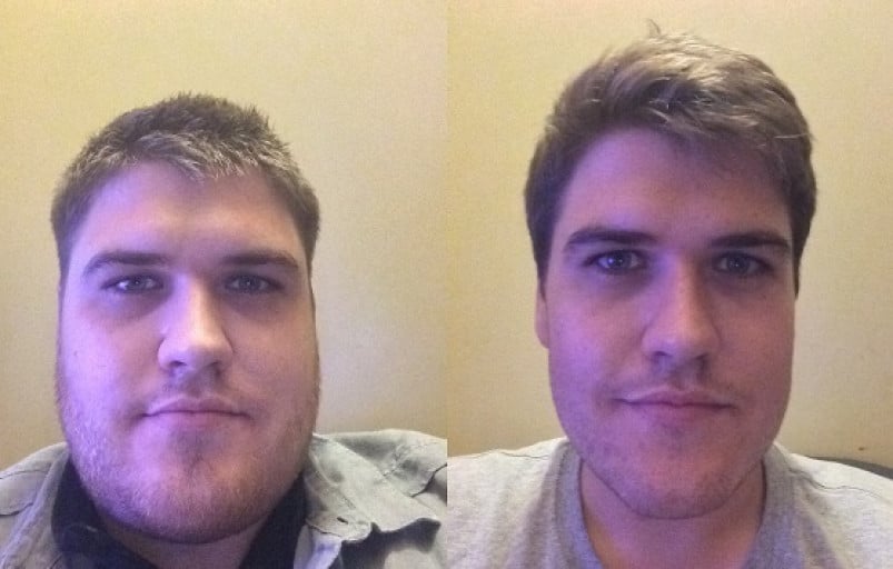 A before and after photo of a 5'10" male showing a weight reduction from 300 pounds to 220 pounds. A respectable loss of 80 pounds.