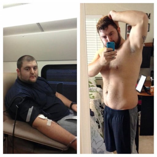 A before and after photo of a 5'11" male showing a weight reduction from 350 pounds to 249 pounds. A total loss of 101 pounds.