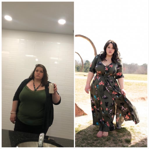 A before and after photo of a 5'7" female showing a weight reduction from 430 pounds to 238 pounds. A total loss of 192 pounds.