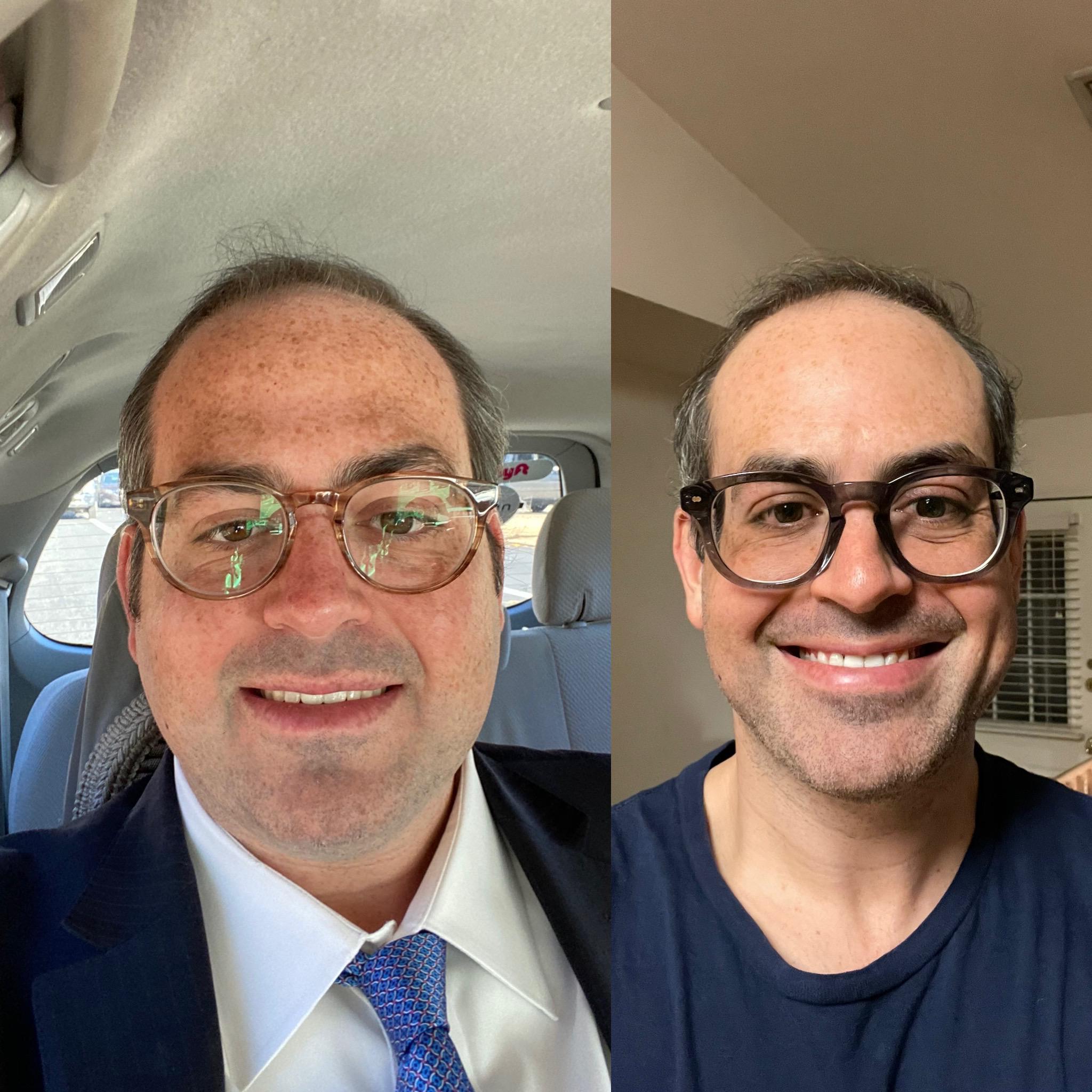 6 foot 4 Male Progress Pics of 86 lbs Weight Loss 332 lbs to 246 lbs